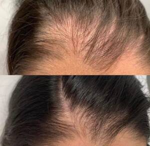 1ea58d2393fdaaa9ea027b996de448ae