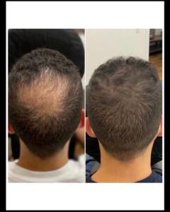 de54779339b4dfa9b4e6666f8b812692